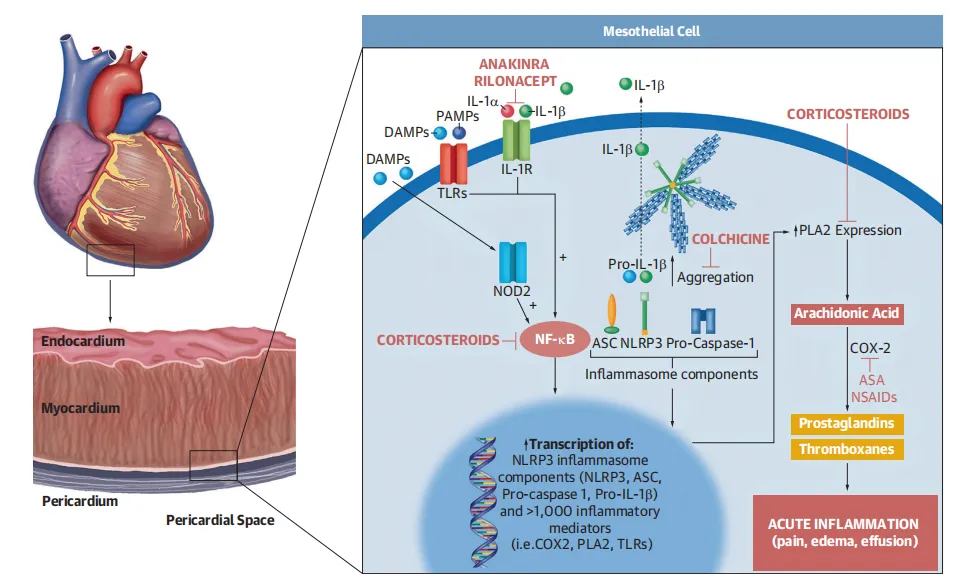 重磅！2025ACC心包炎诊疗指南大升级：诊断新标准、IL‑1上位、影像分型一图掌握！
